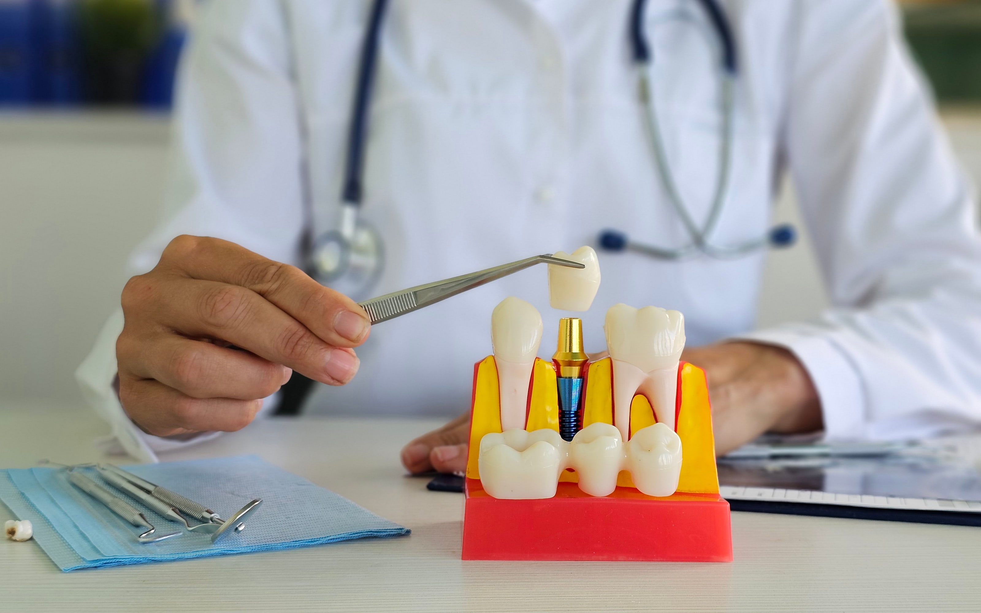 Stress-free dental implant experience with compassionate care in a comfortable and welcoming clinic.