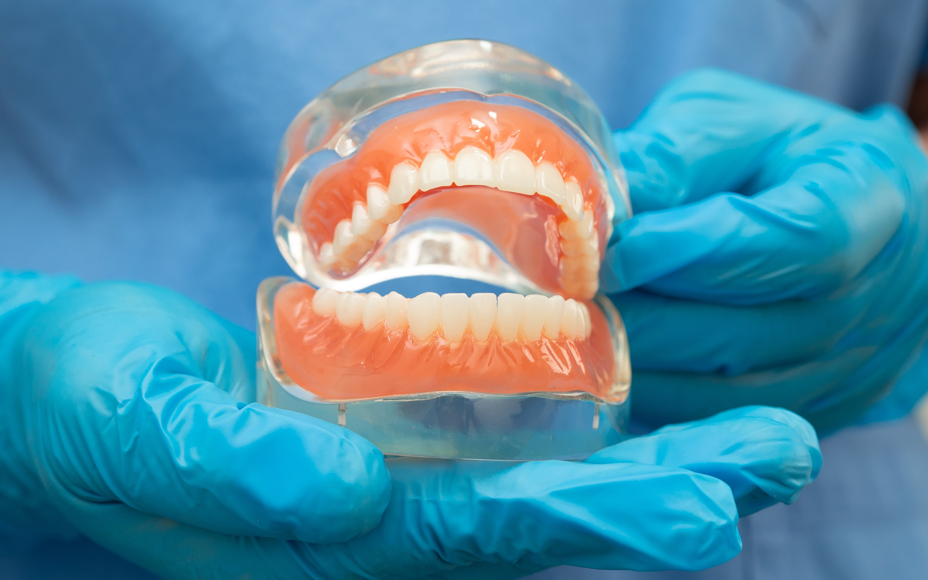 Dental implants as alternative