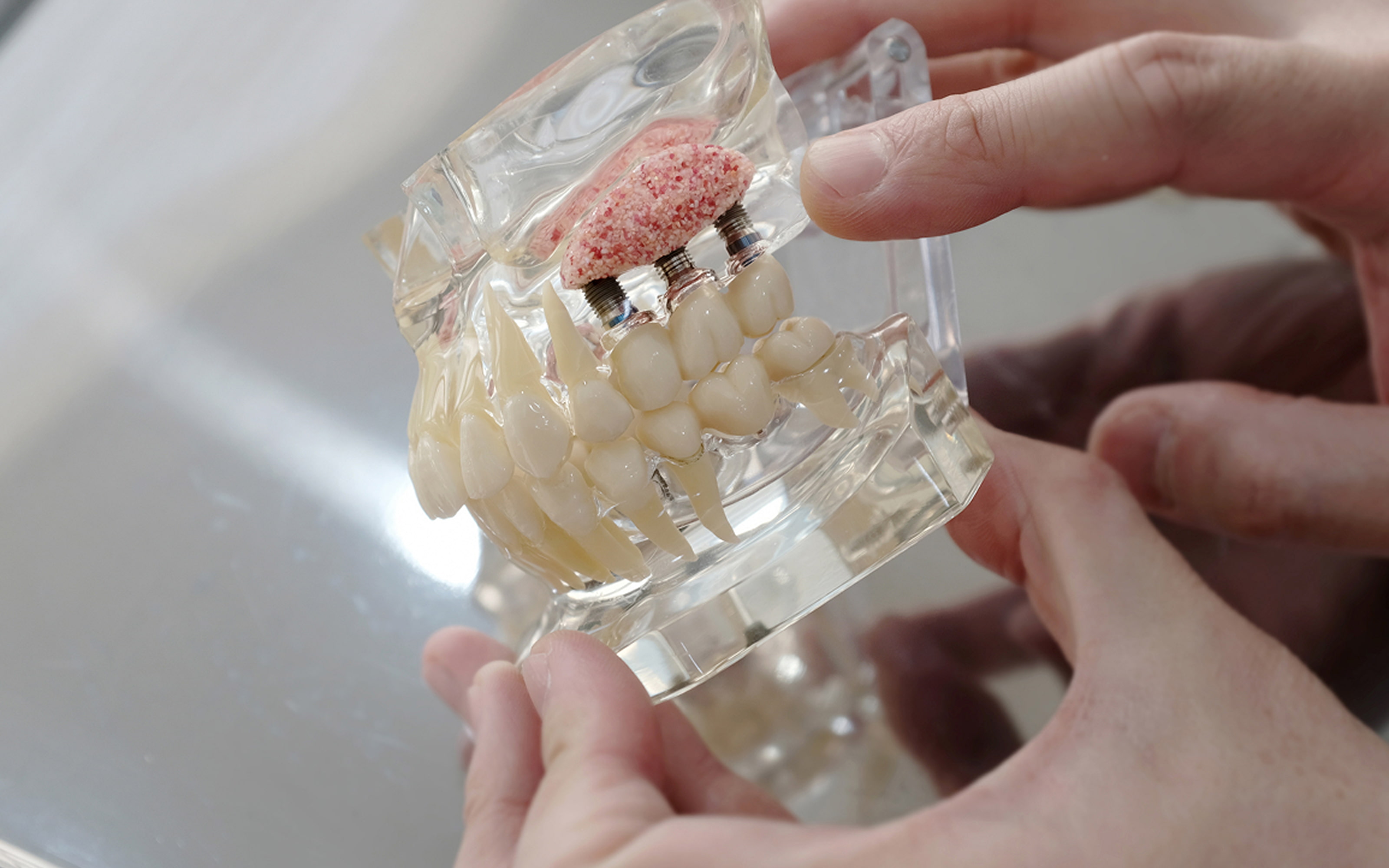 Why bone grafting is important