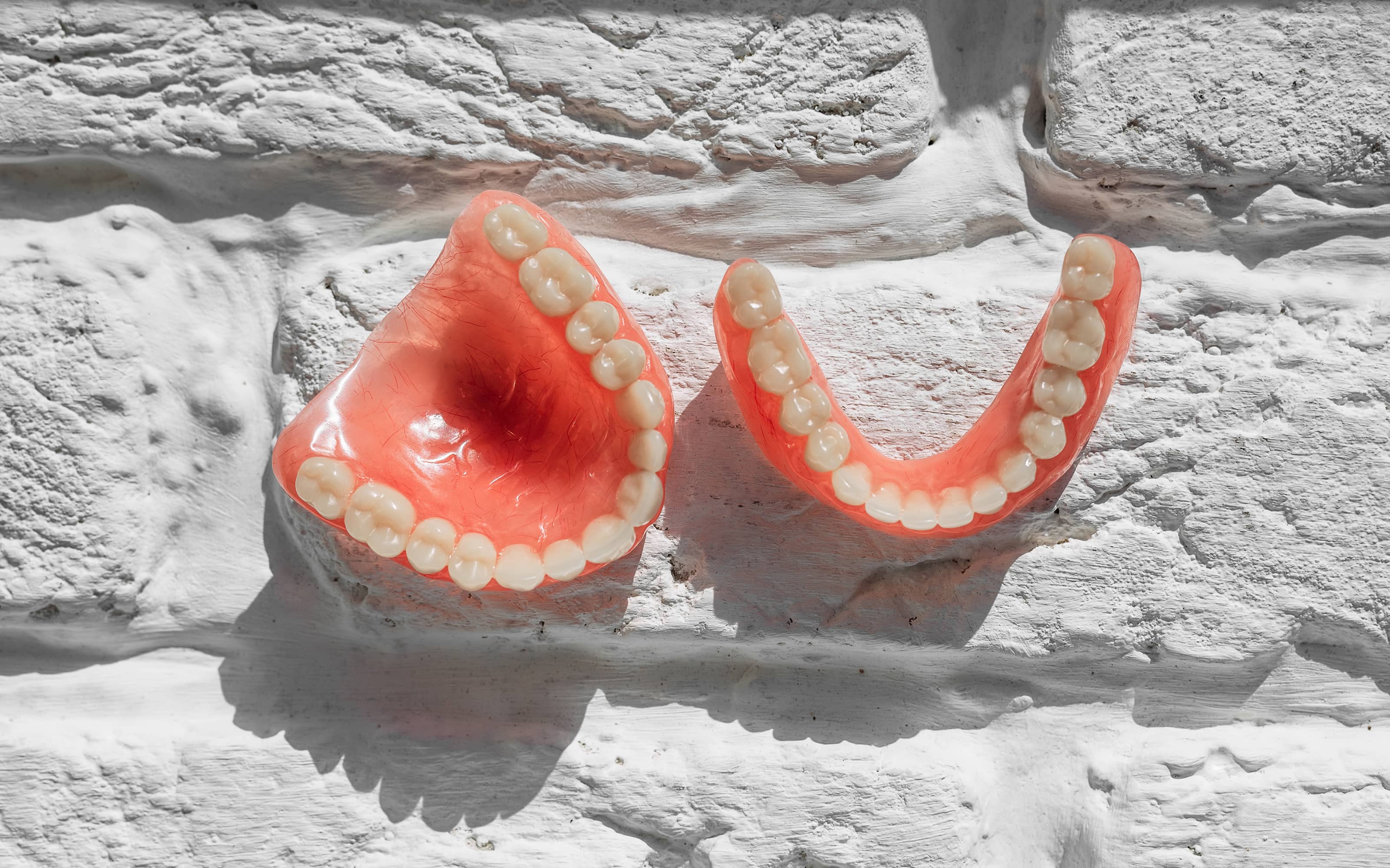 Dental implant restoration services