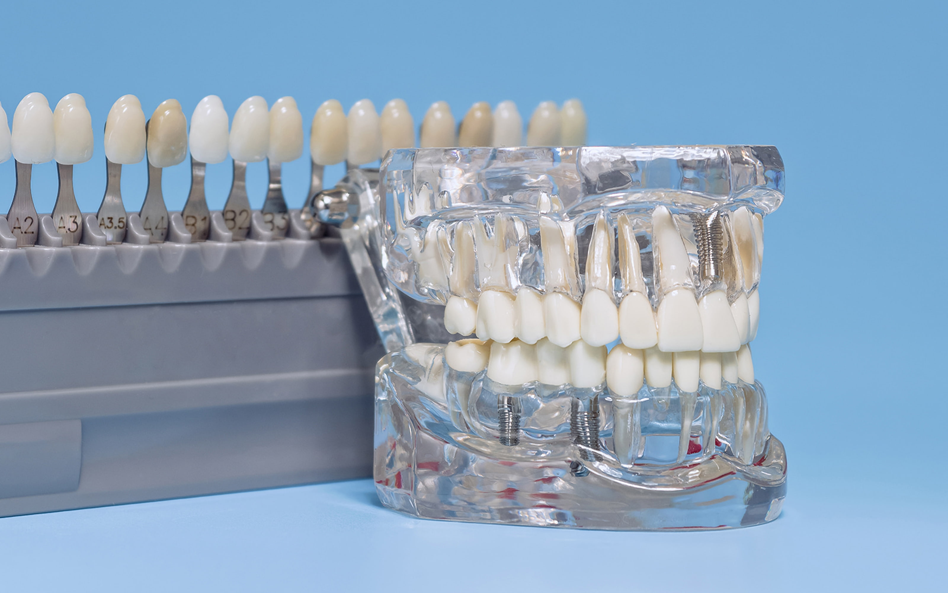 Protecting your dental implant investment