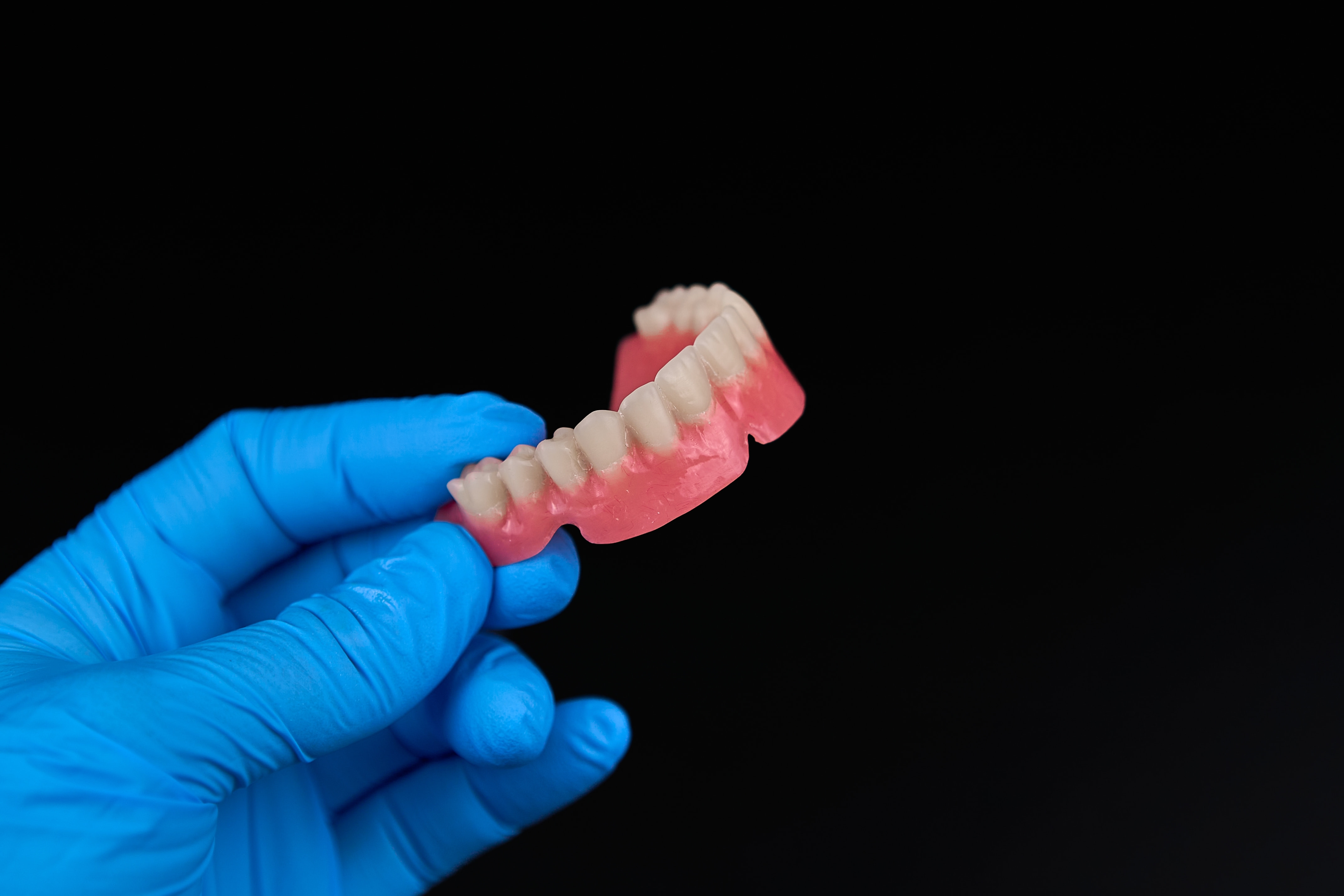 What are dentures