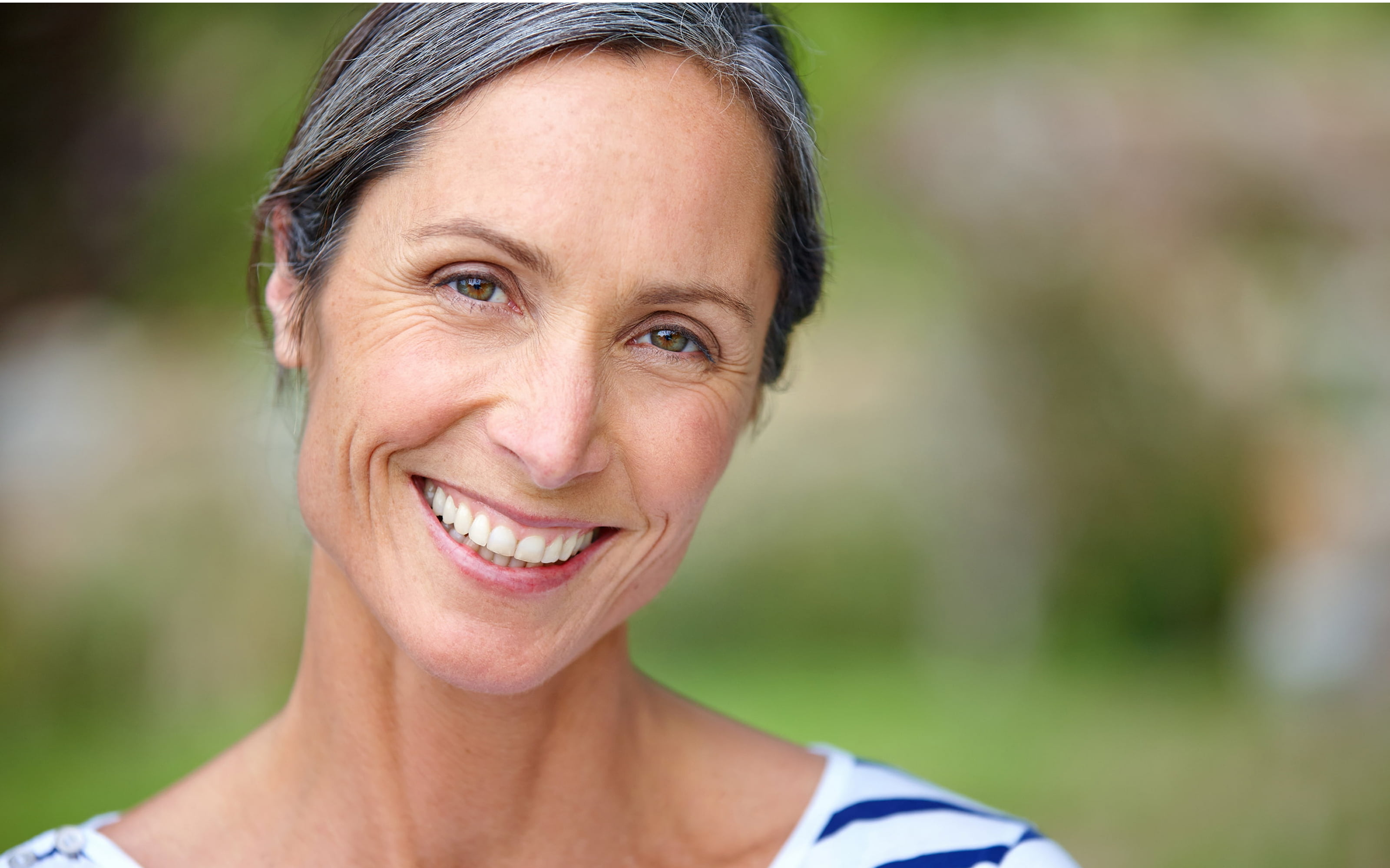 Full mouth dental implants