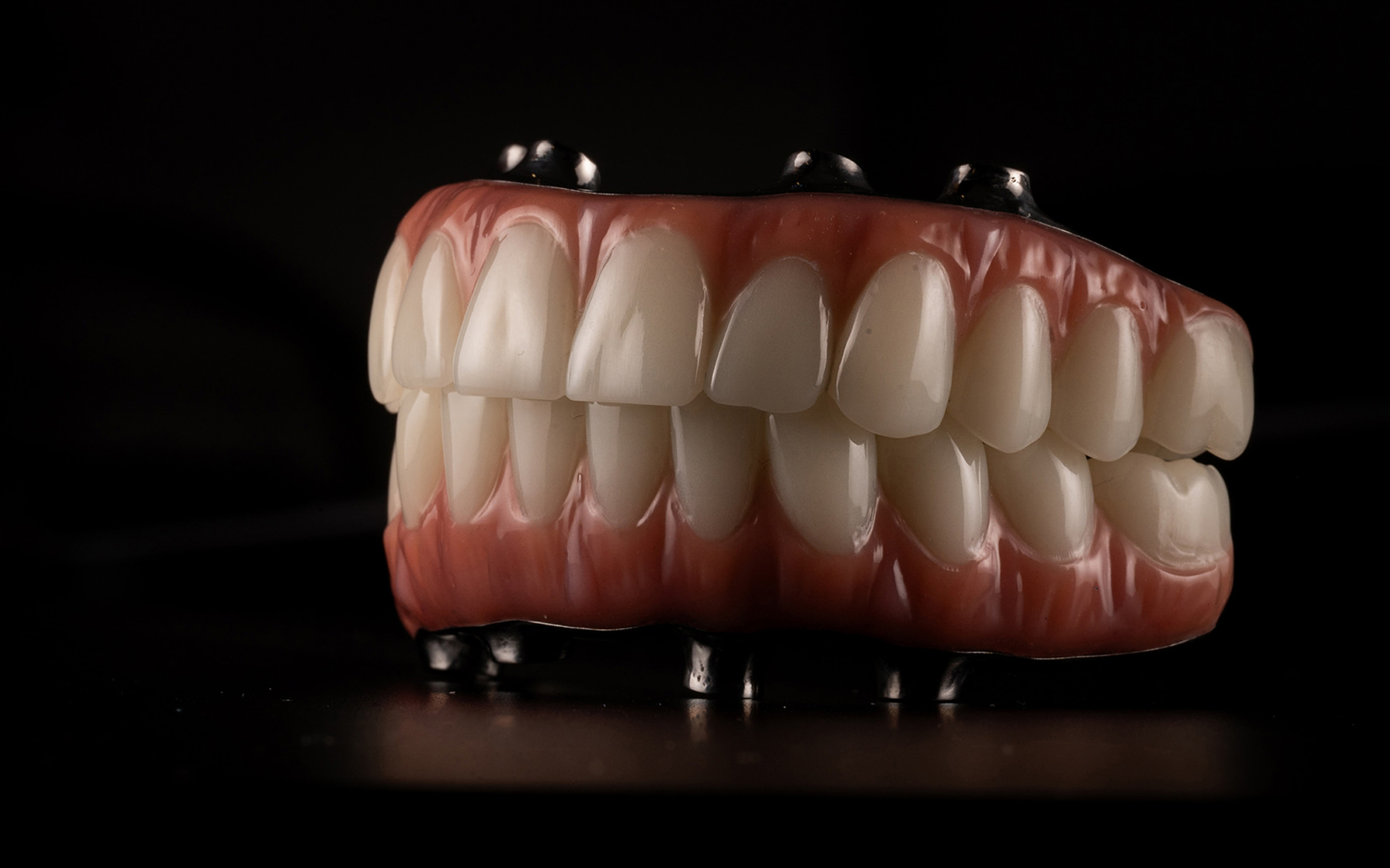 Candidates for full mouth dental implants