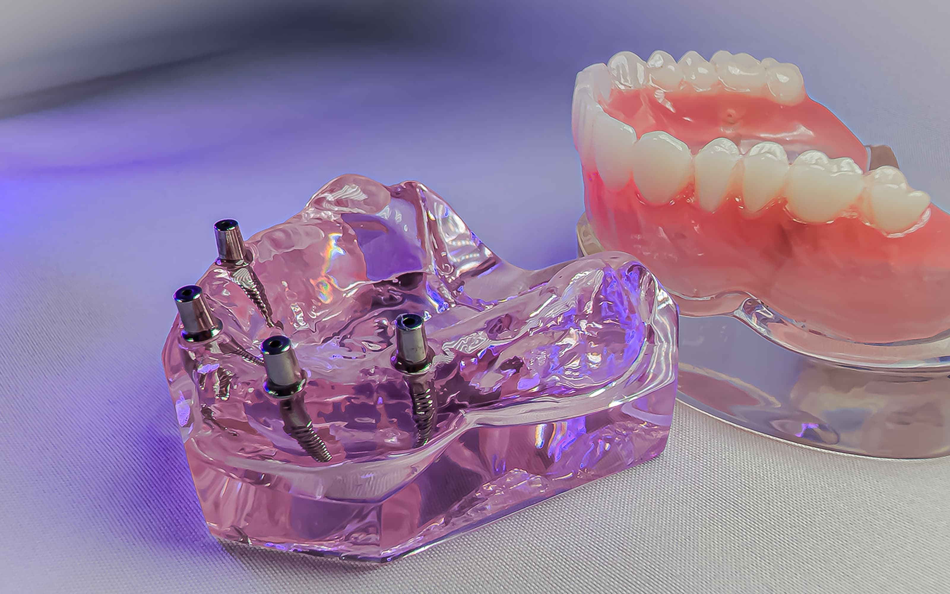 Why choose implant-supported dentures