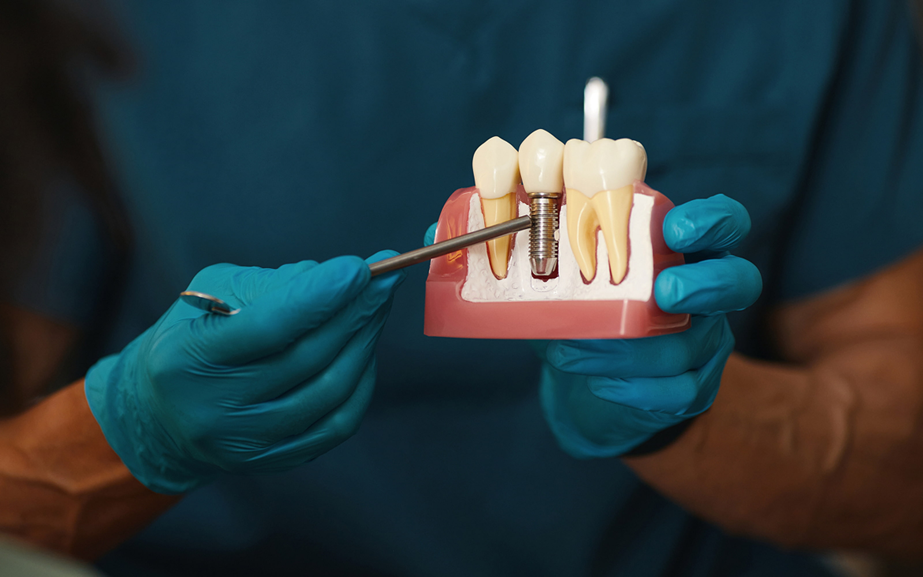 Why choose a single tooth implant